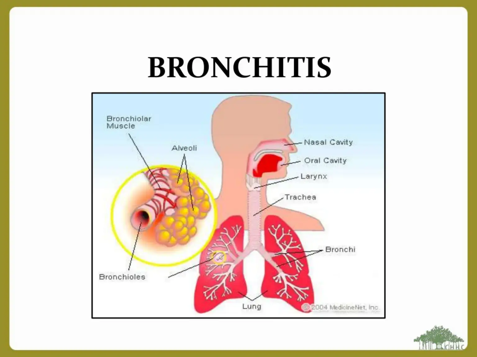 غلاف كتاب BRONCHITIS