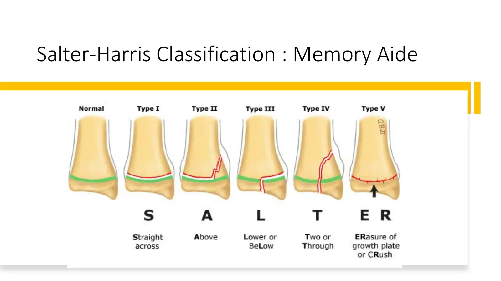 غلاف كتاب Salter-Harris Classification: Memory Aide