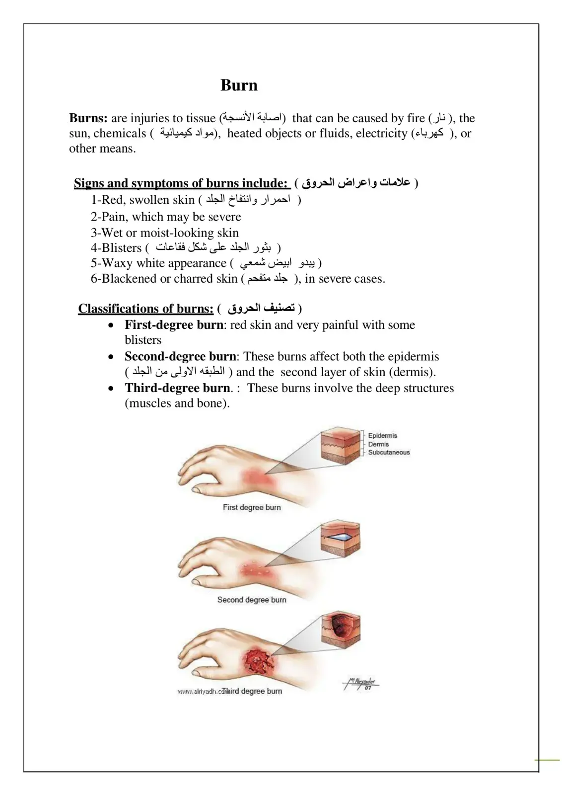 غلاف كتاب Burns - الحروق