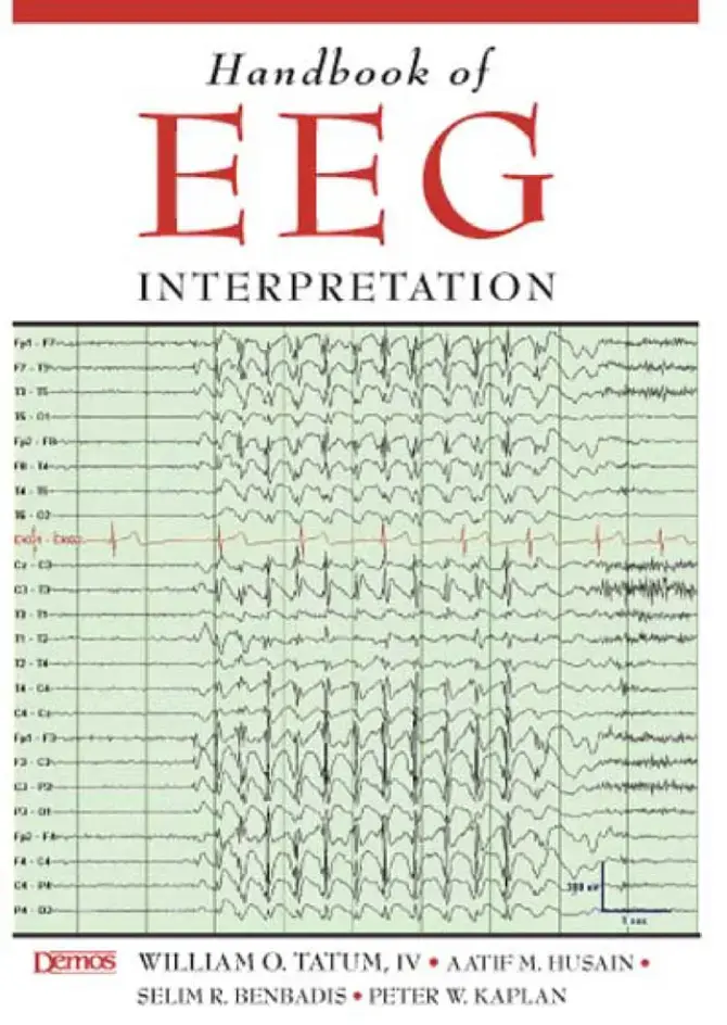 غلاف كتاب Handbook of EEG Interpretation