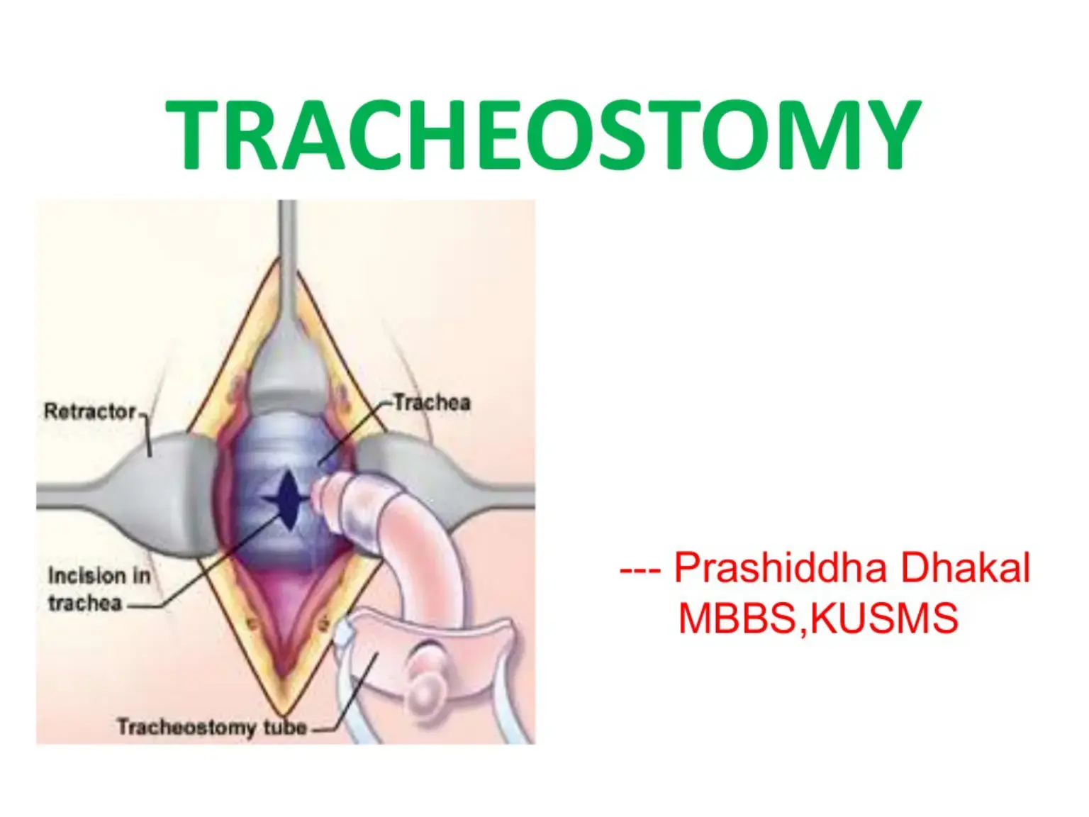 غلاف كتاب TRACHEOSTOMY
