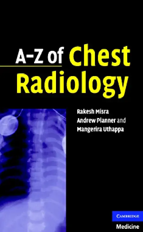 غلاف كتاب A-Z of Chest Radiology