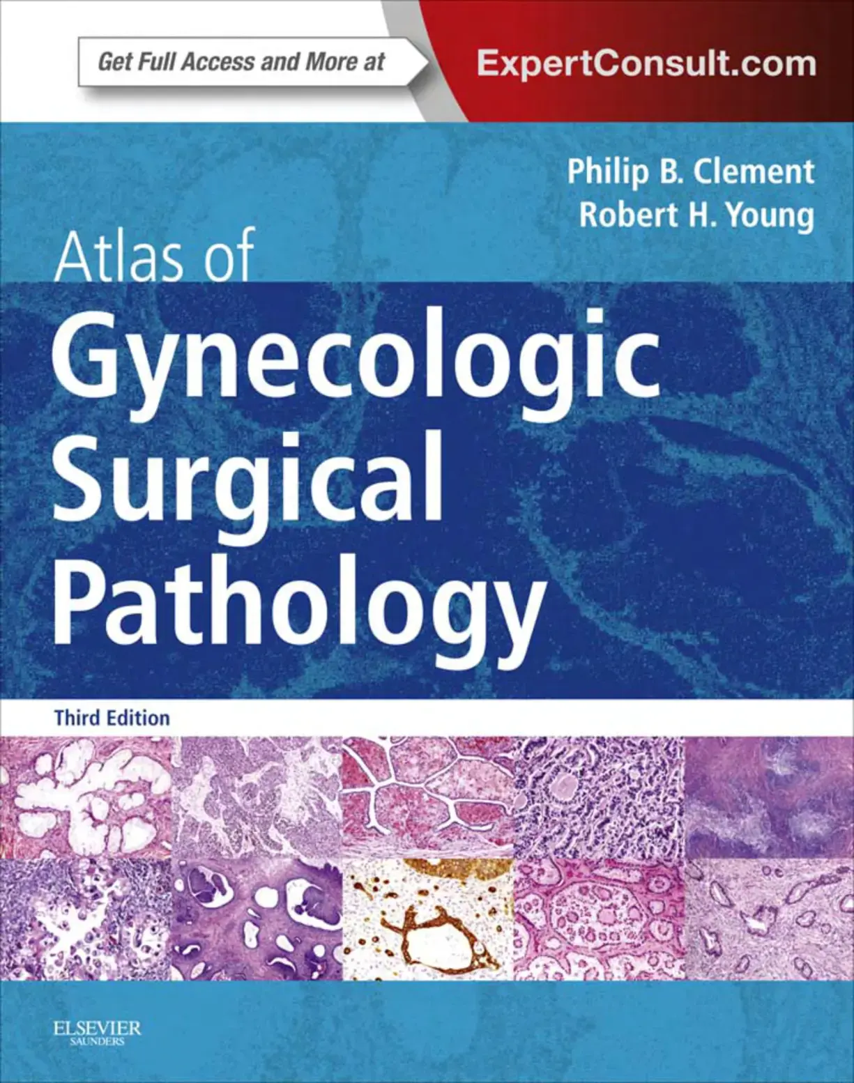 غلاف كتاب Atlas of Gynecologic Surgical Pathology