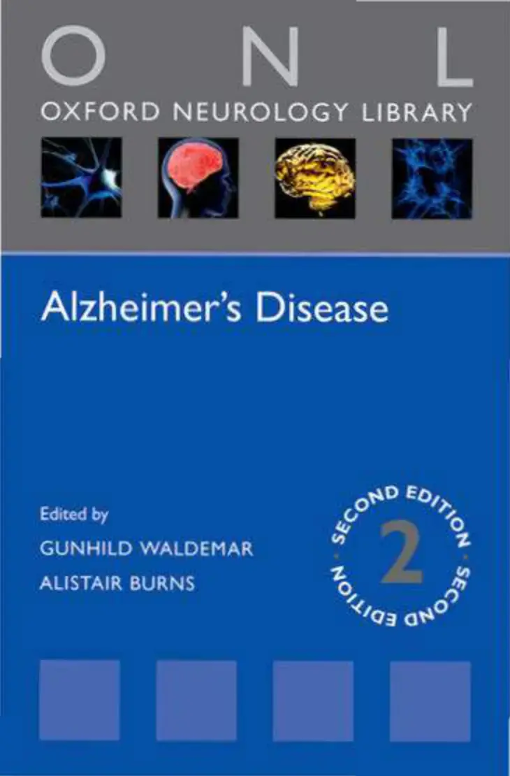غلاف كتاب Alzheimer's Disease