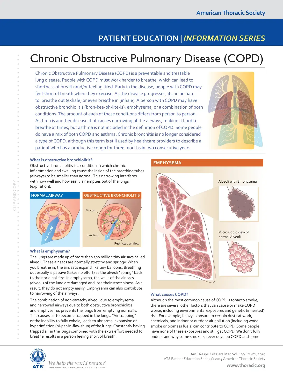 غلاف كتاب Chronic Obstructive Pulmonary Disease (COPD)