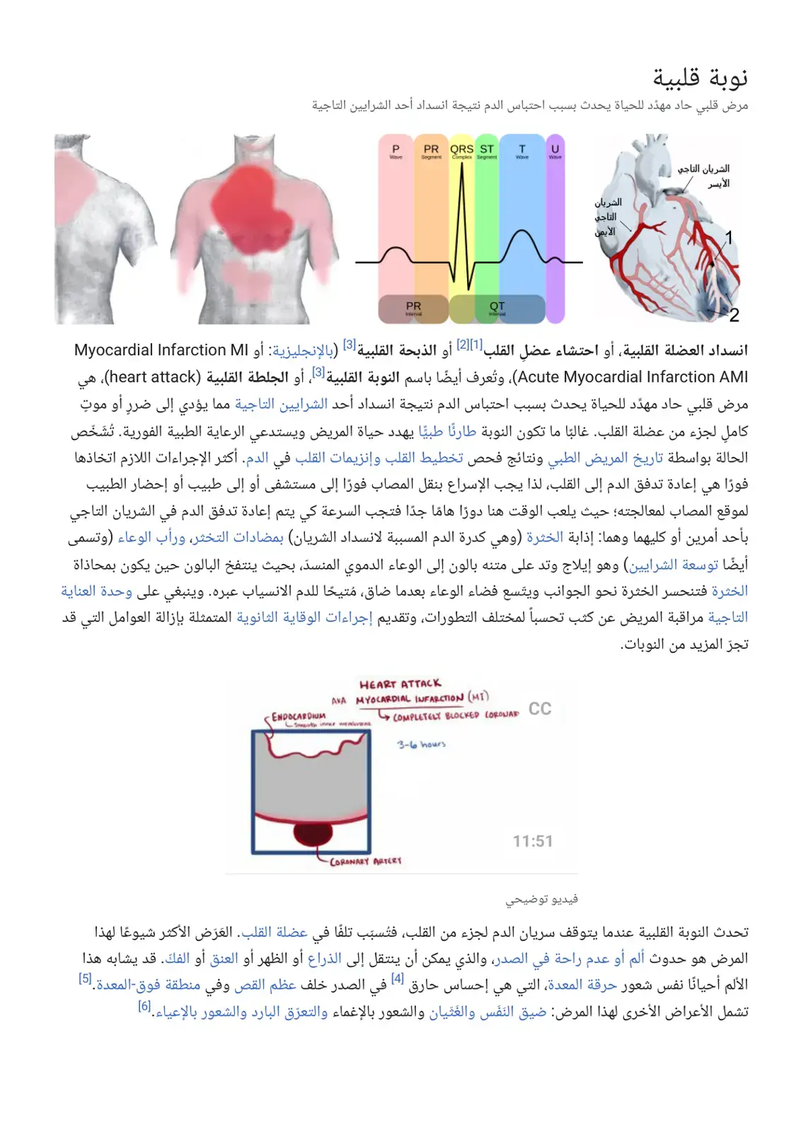 غلاف كتاب النوبة القلبية واحتشاء عضل القلب