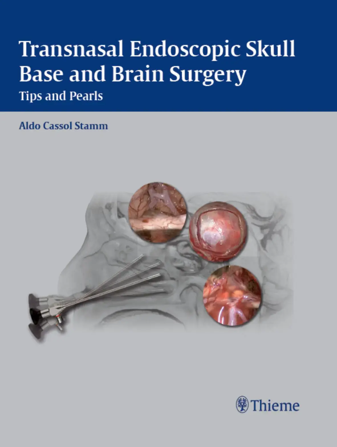 غلاف كتاب Transnasal Endoscopic Skull Base and Brain Surgery Tips and Pearls