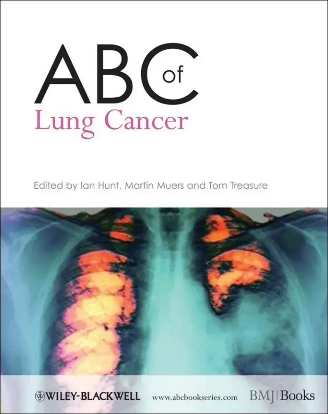 غلاف كتاب Lung Cancer