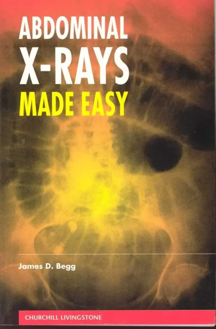 غلاف كتاب ABDOMINAL X-RAYS MADE EASY