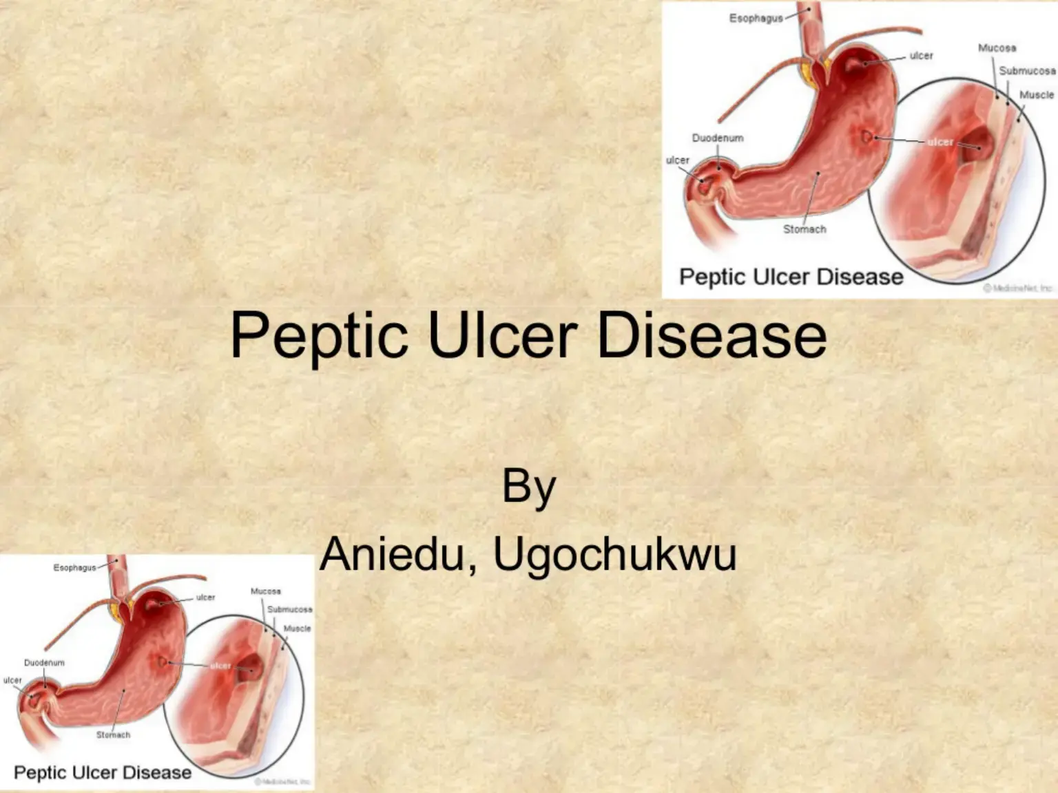 غلاف كتاب Peptic Ulcer Disease