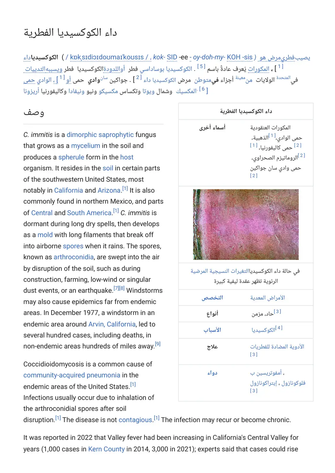 غلاف كتاب داء الكوكسيديا الفطرية