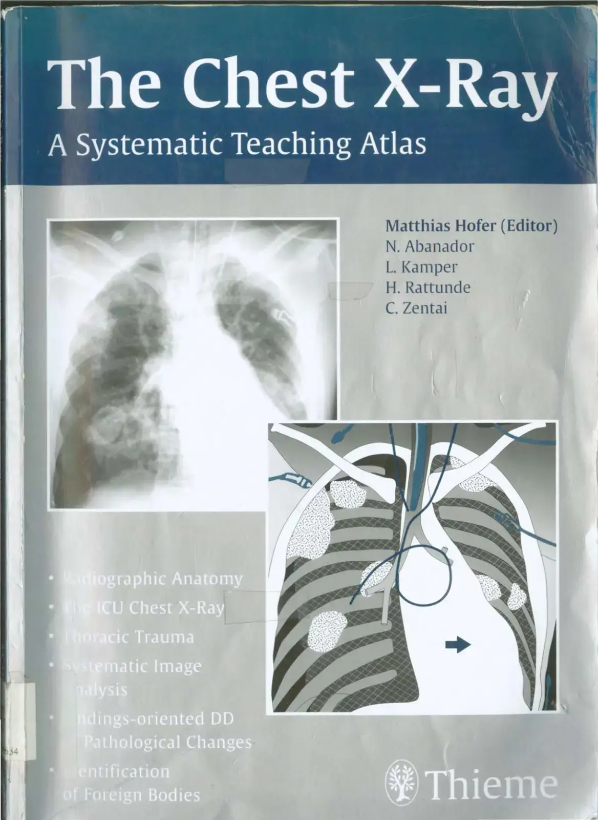 غلاف كتاب The Chest X-Ray: A Systematic Teaching Atlas