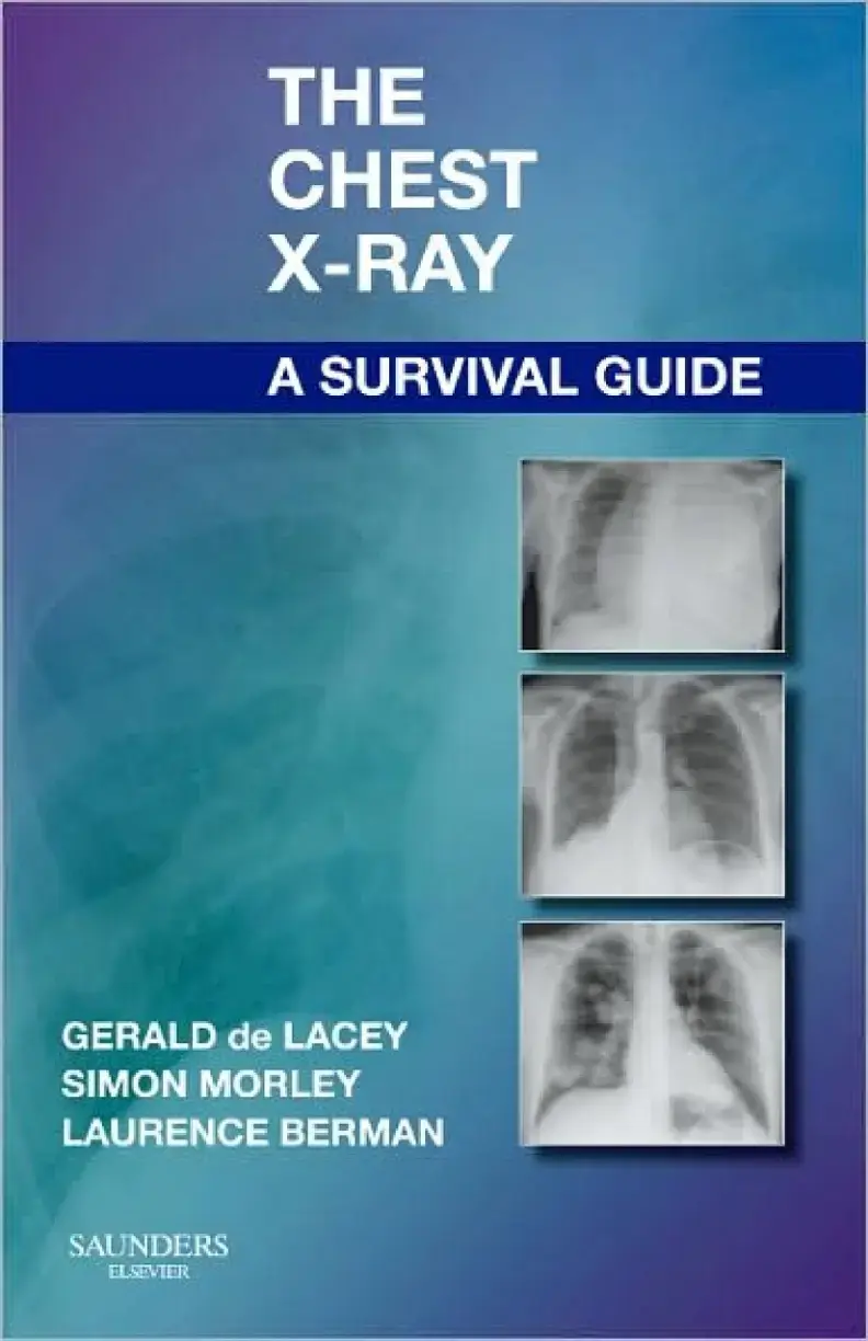غلاف كتاب The Chest X-Ray: A Survival Guide