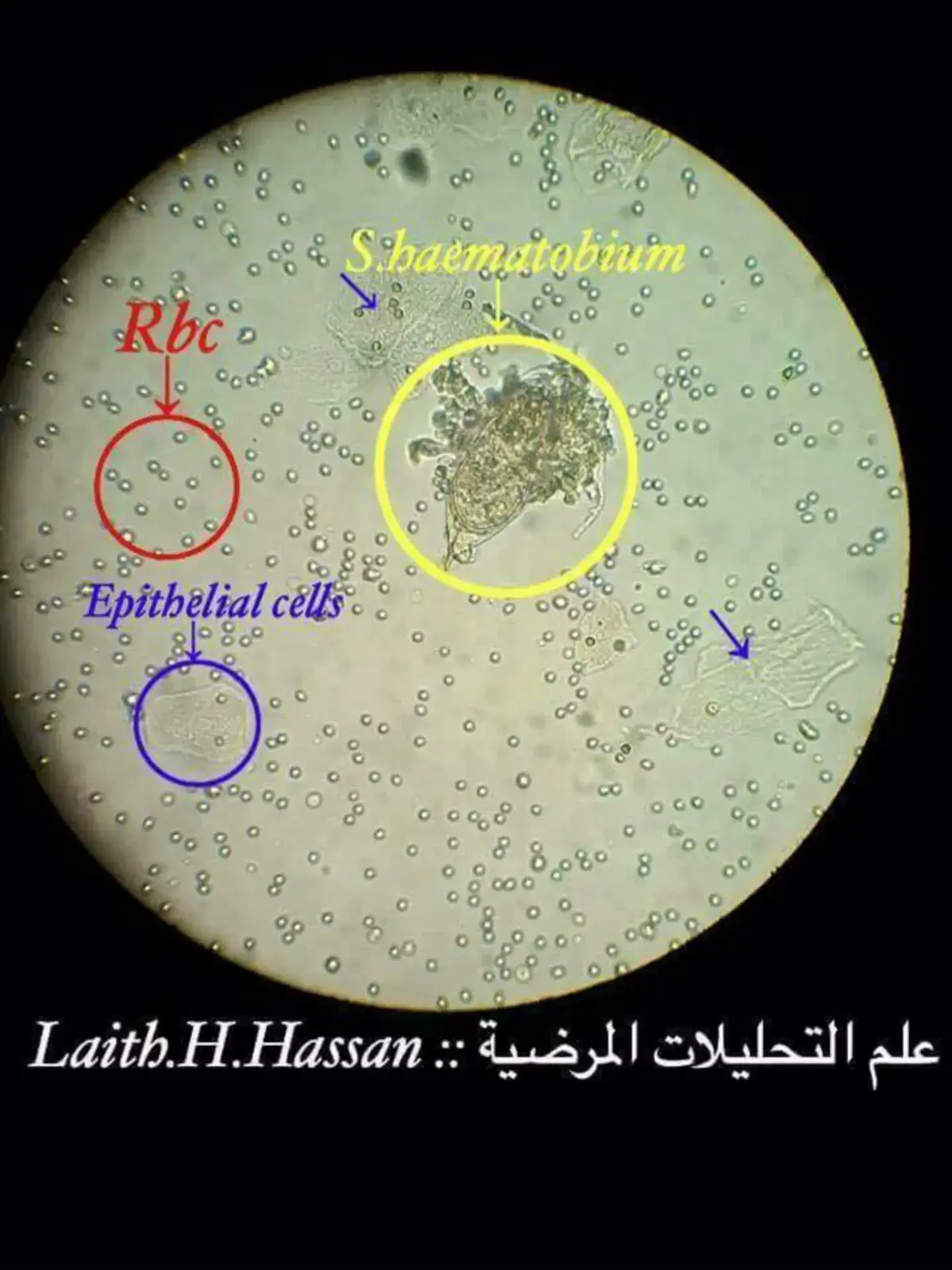 غلاف كتاب علم التحليلات المرضية