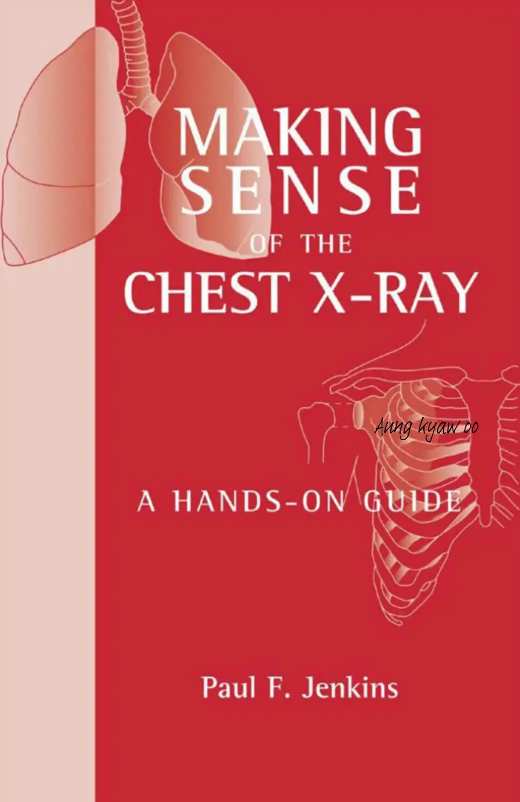 غلاف كتاب MAKING SENSE OF THE CHEST X-RAY