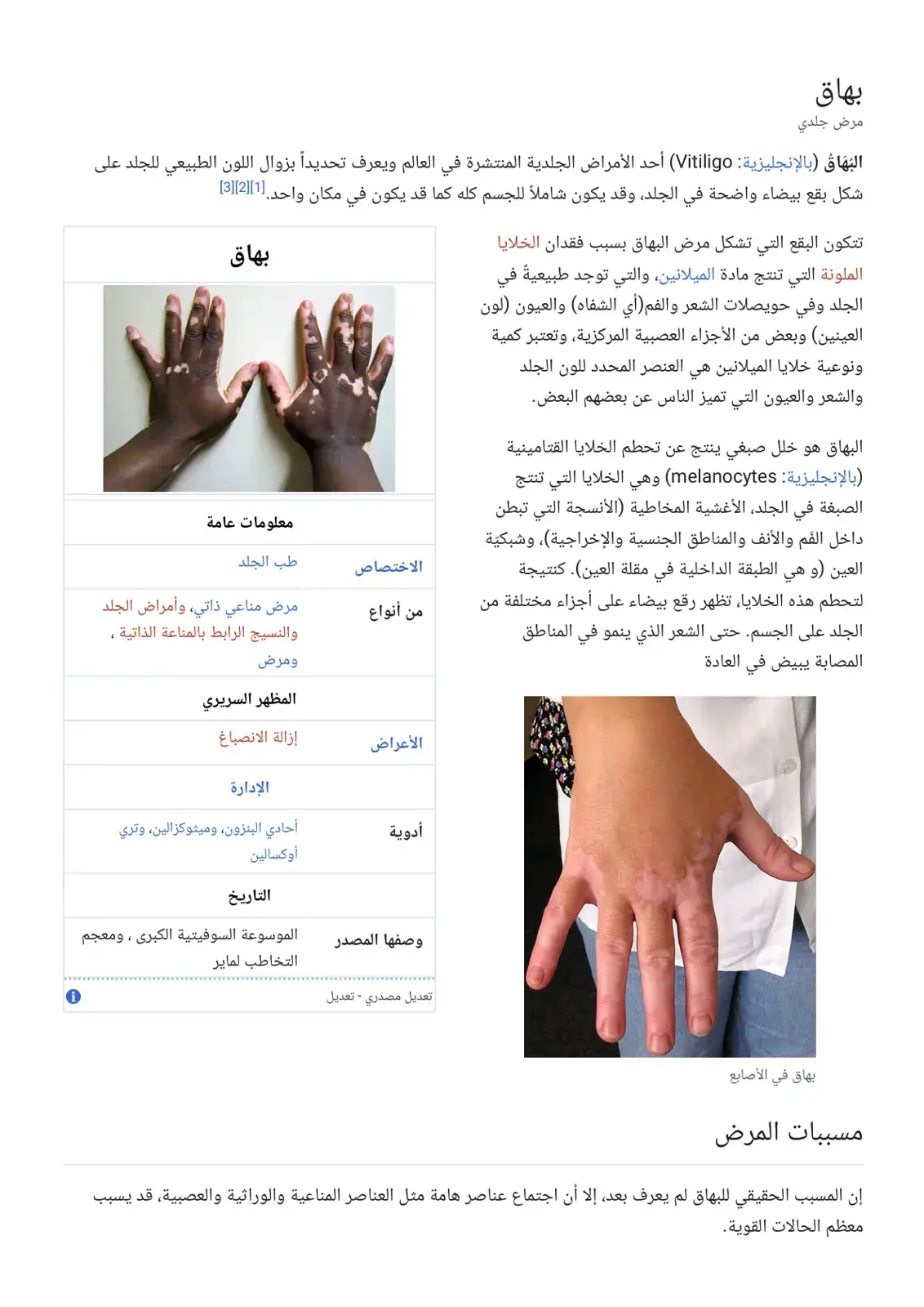 غلاف كتاب البهاق: المرض الجلدي