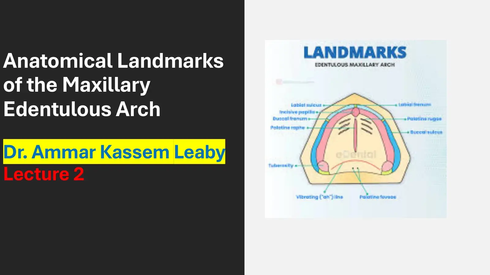 غلاف كتاب LANDMARKS EDENTULOUS MAXILLARY ARCH
