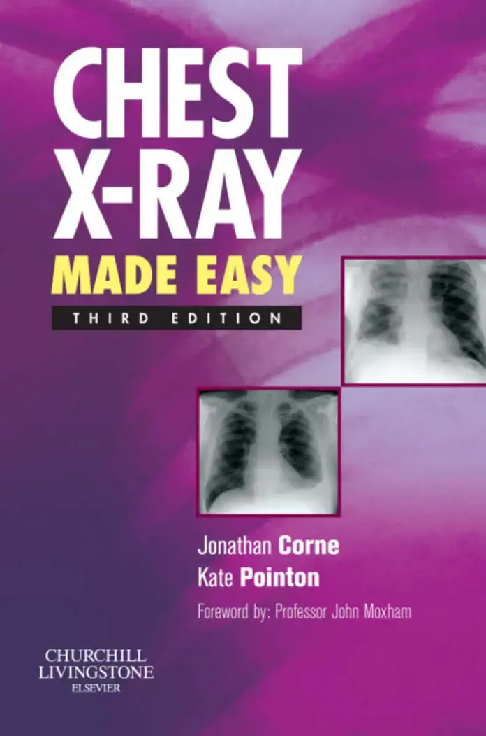غلاف كتاب CHEST X-RAY MADE EASY