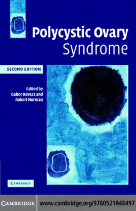 غلاف كتاب Polycystic Ovary Syndrome