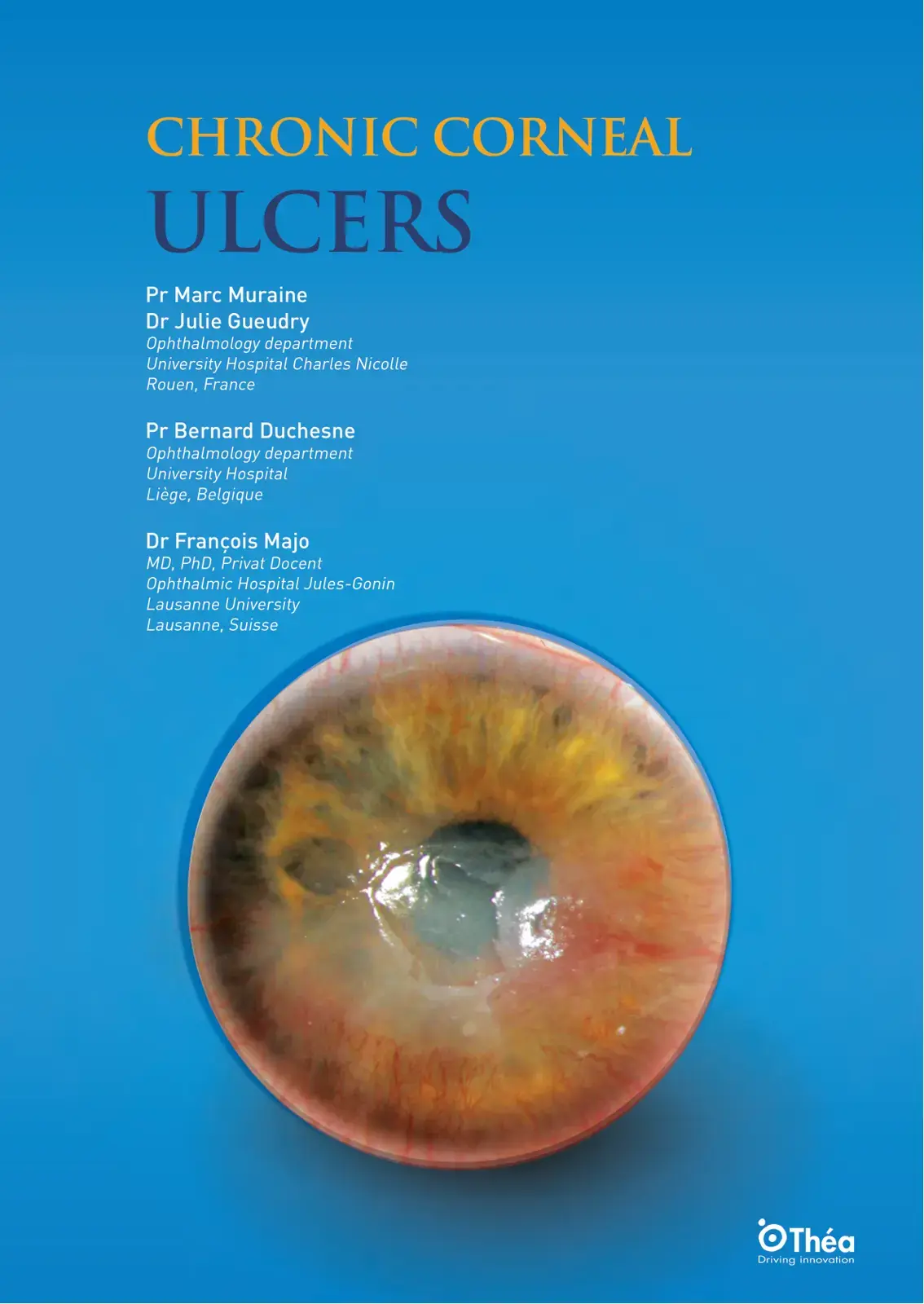 غلاف كتاب Chronic Corneal Ulcers