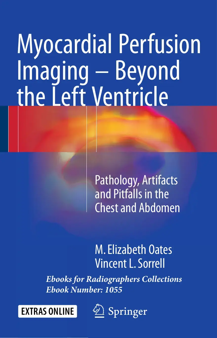 غلاف كتاب Myocardial Perfusion Imaging - Beyond the Left Ventricle: Pathology, Artifacts and Pitfalls in the Chest and Abdomen
