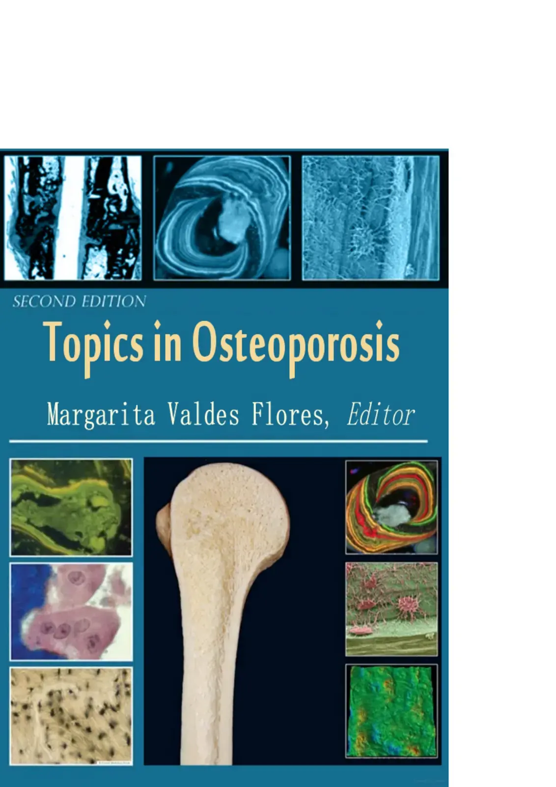 غلاف كتاب Topics in Osteoporosis