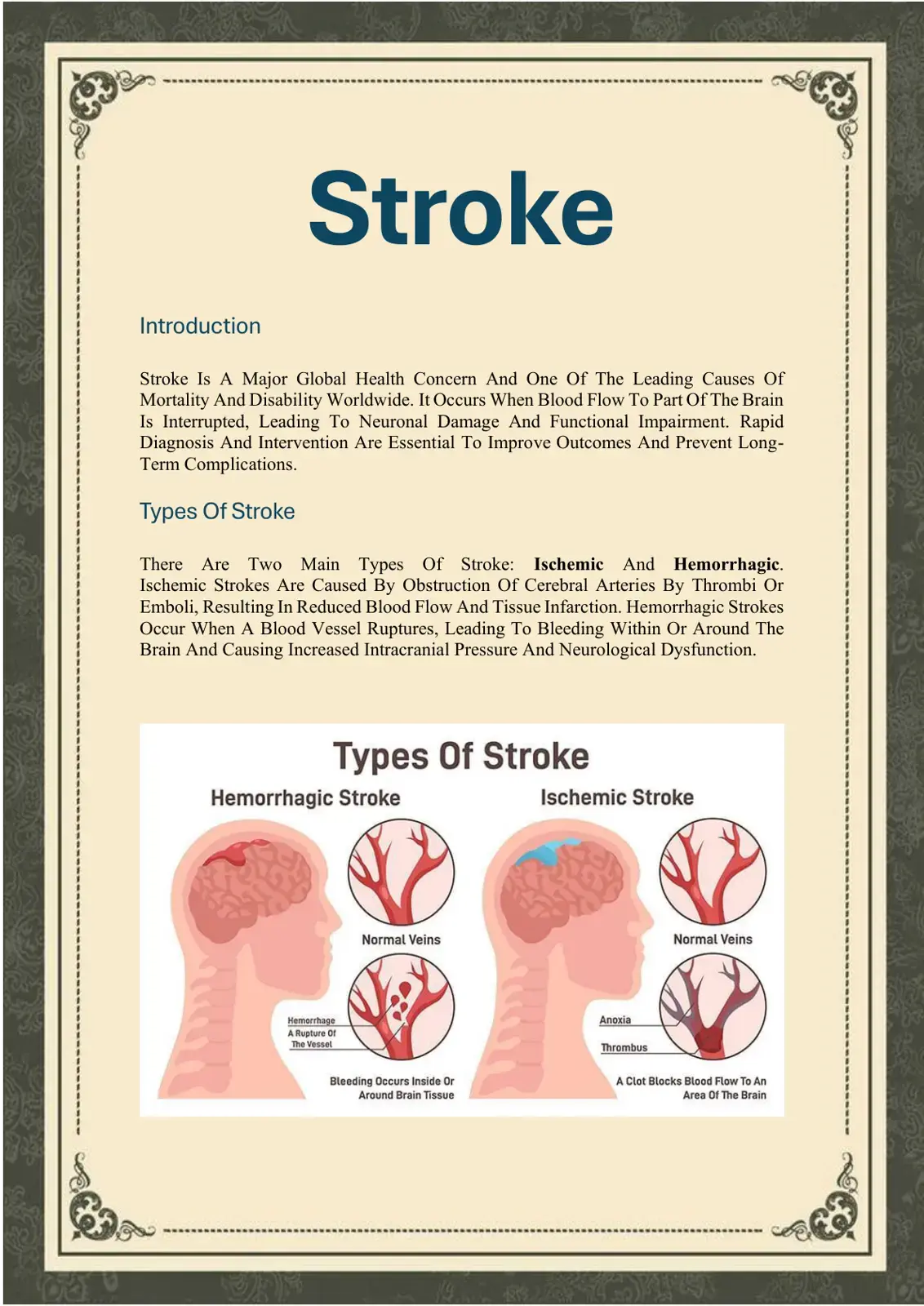 غلاف كتاب Stroke