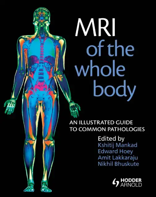 غلاف كتاب MRI of the Whole Body: An Illustrated Guide to Common Pathologies
