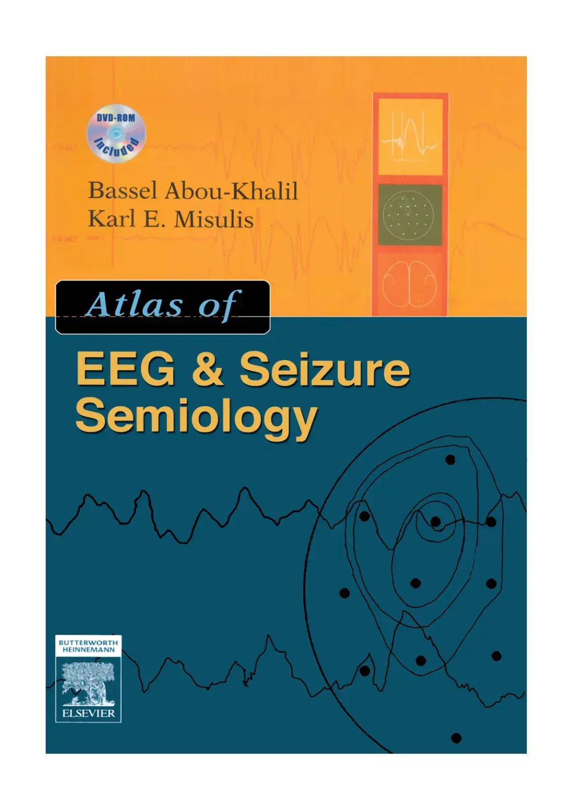 غلاف كتاب Atlas of EEG & Seizure Semiology