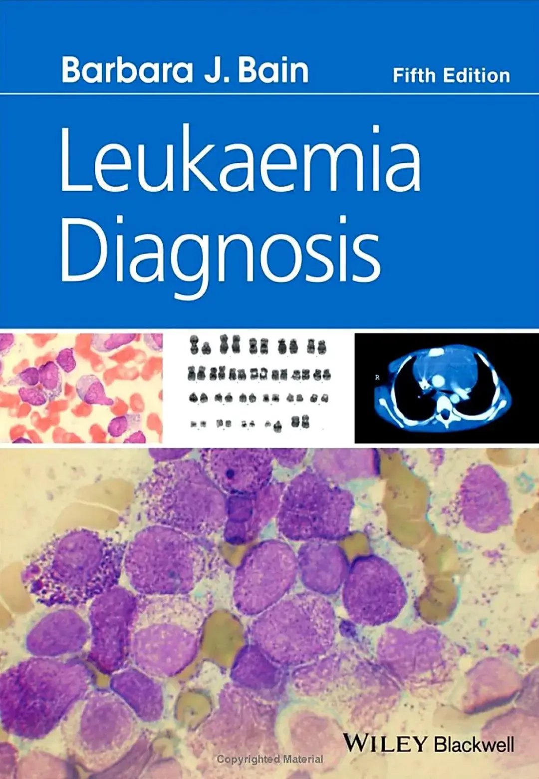 غلاف كتاب Leukaemia Diagnosis