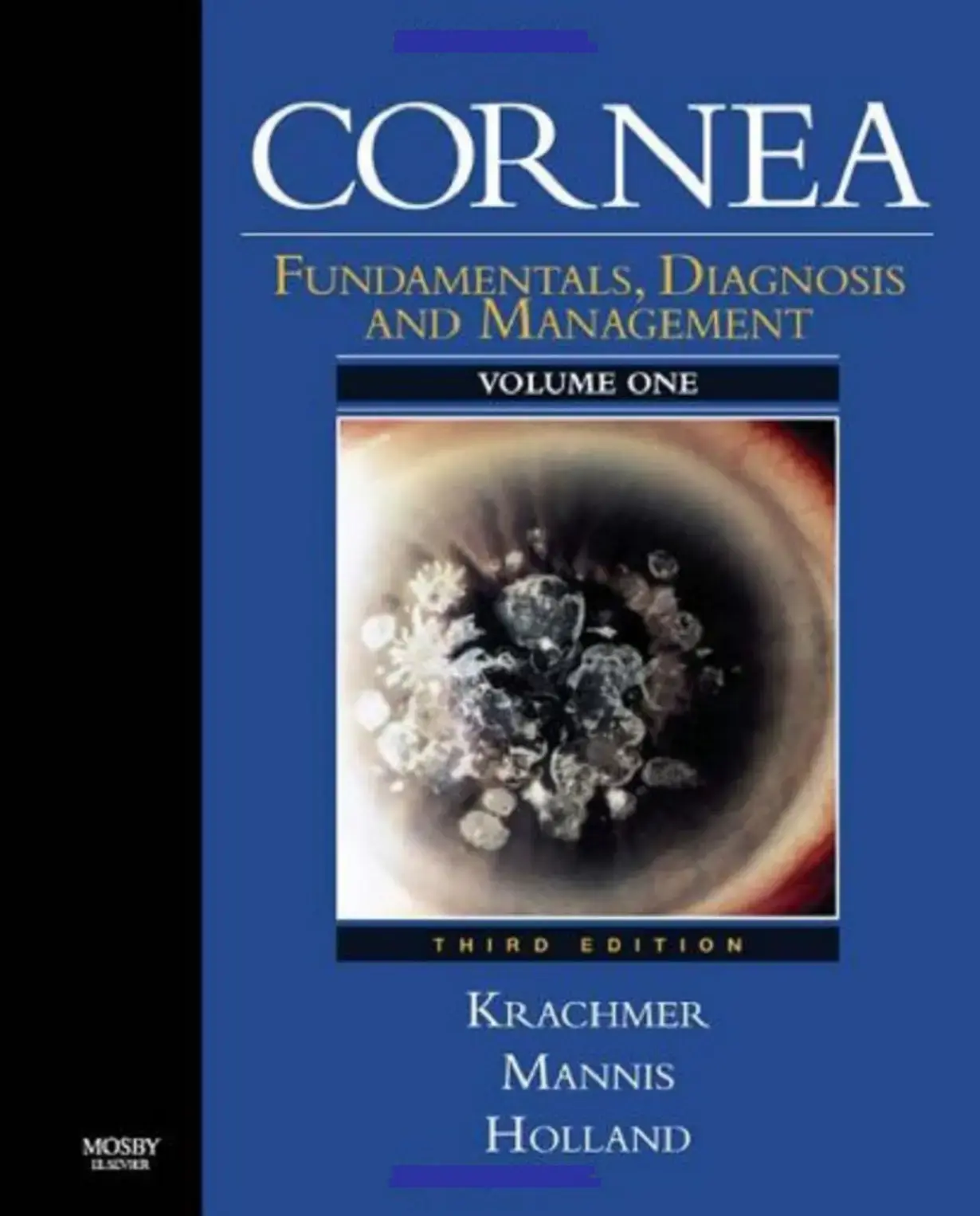 غلاف كتاب Cornea Fundamentals, Diagnosis and Management