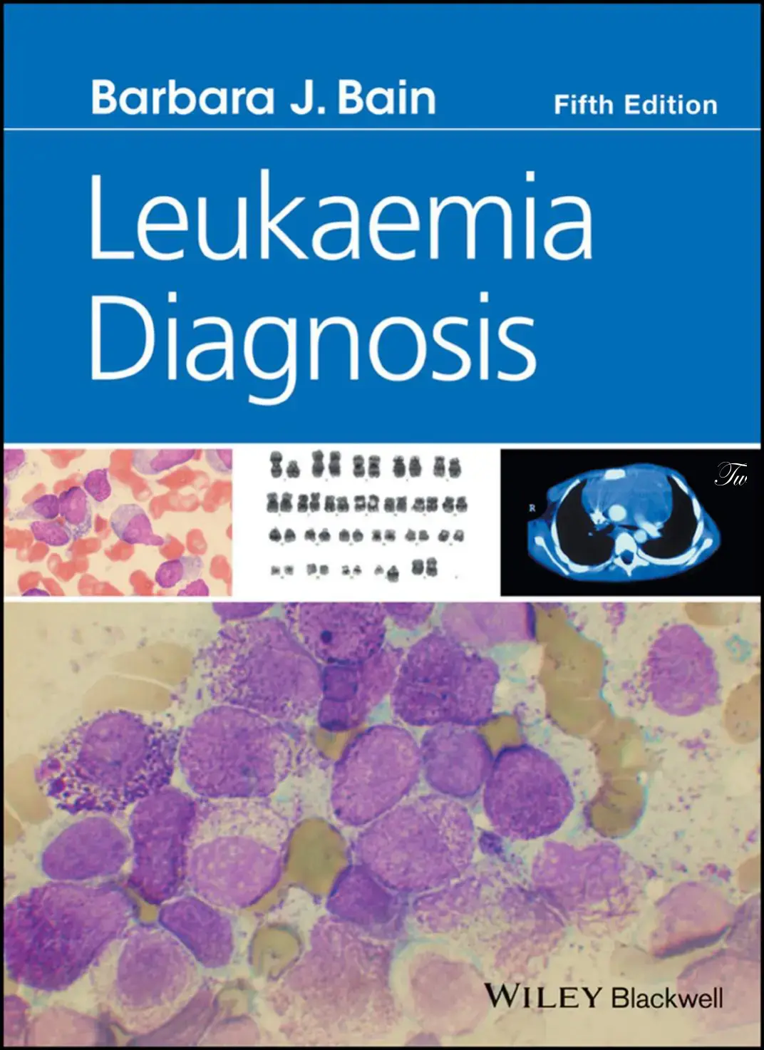 غلاف كتاب Leukaemia Diagnosis