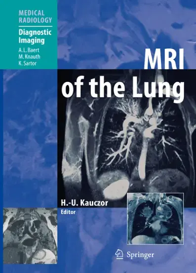 غلاف كتاب MRI of the Lung