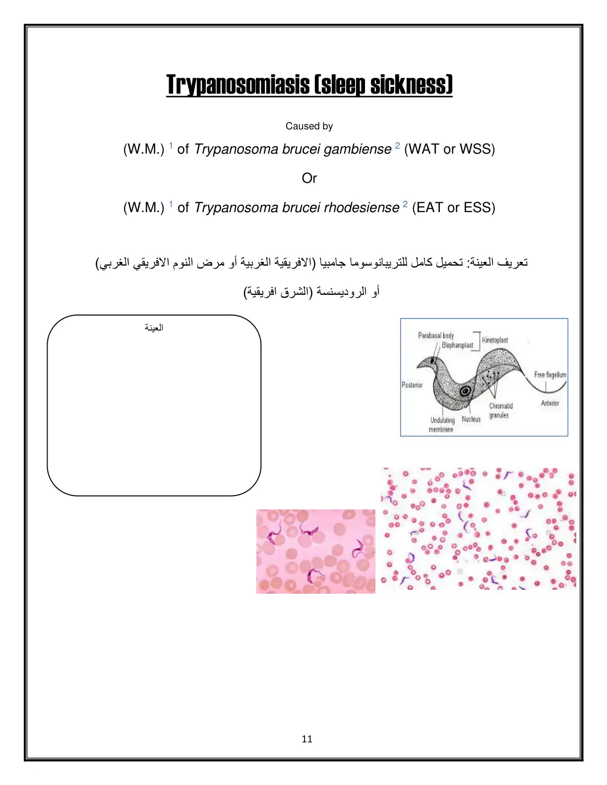 غلاف كتاب Trypanosomiasis (Sleep Sickness)