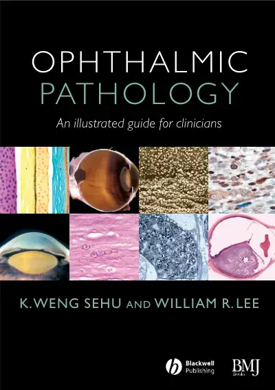 غلاف كتاب OPHTHALMIC PATHOLOGY An illustrated guide for clinicians
