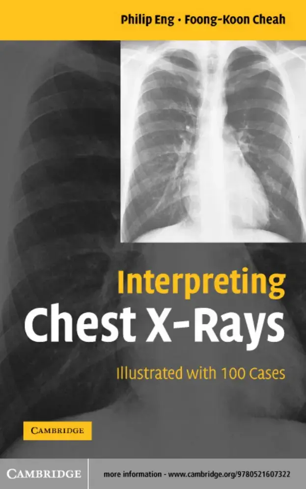غلاف كتاب Interpreting Chest X-Rays