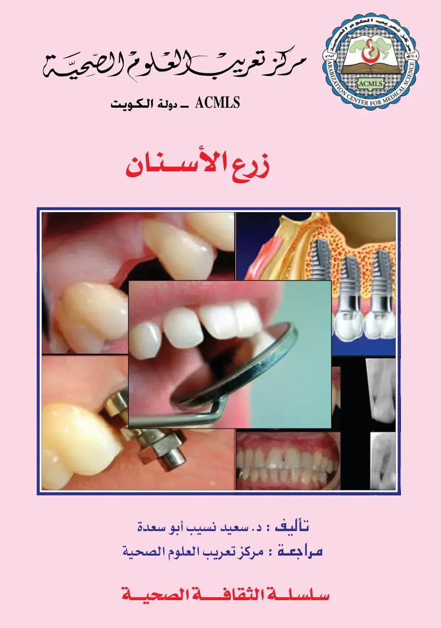 غلاف كتاب زرع الأسنان
