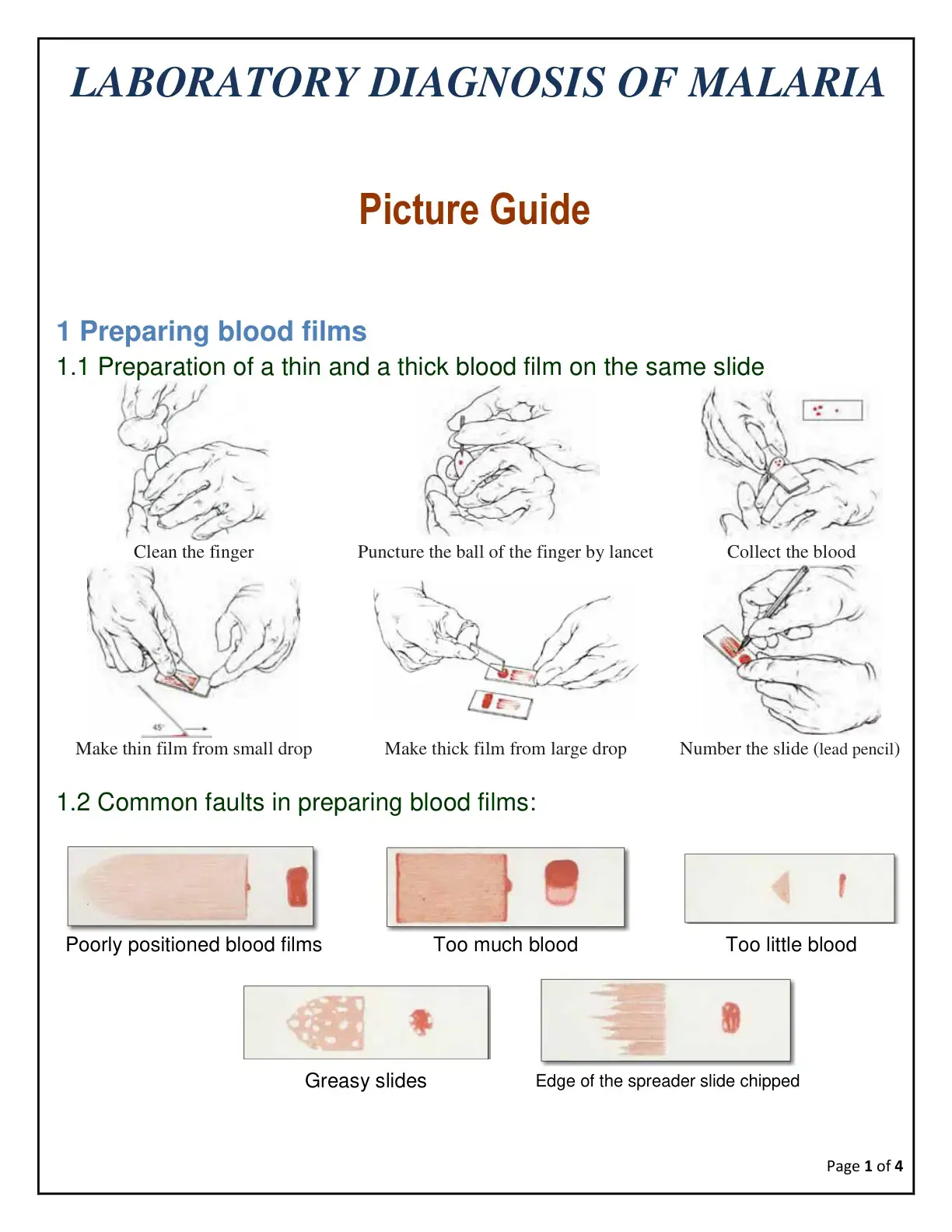 غلاف كتاب Laboratory Diagnosis of Malaria Picture Guide