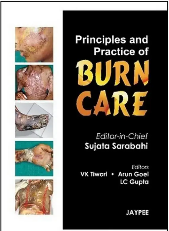 غلاف كتاب Principles and Practice of BURN CARE