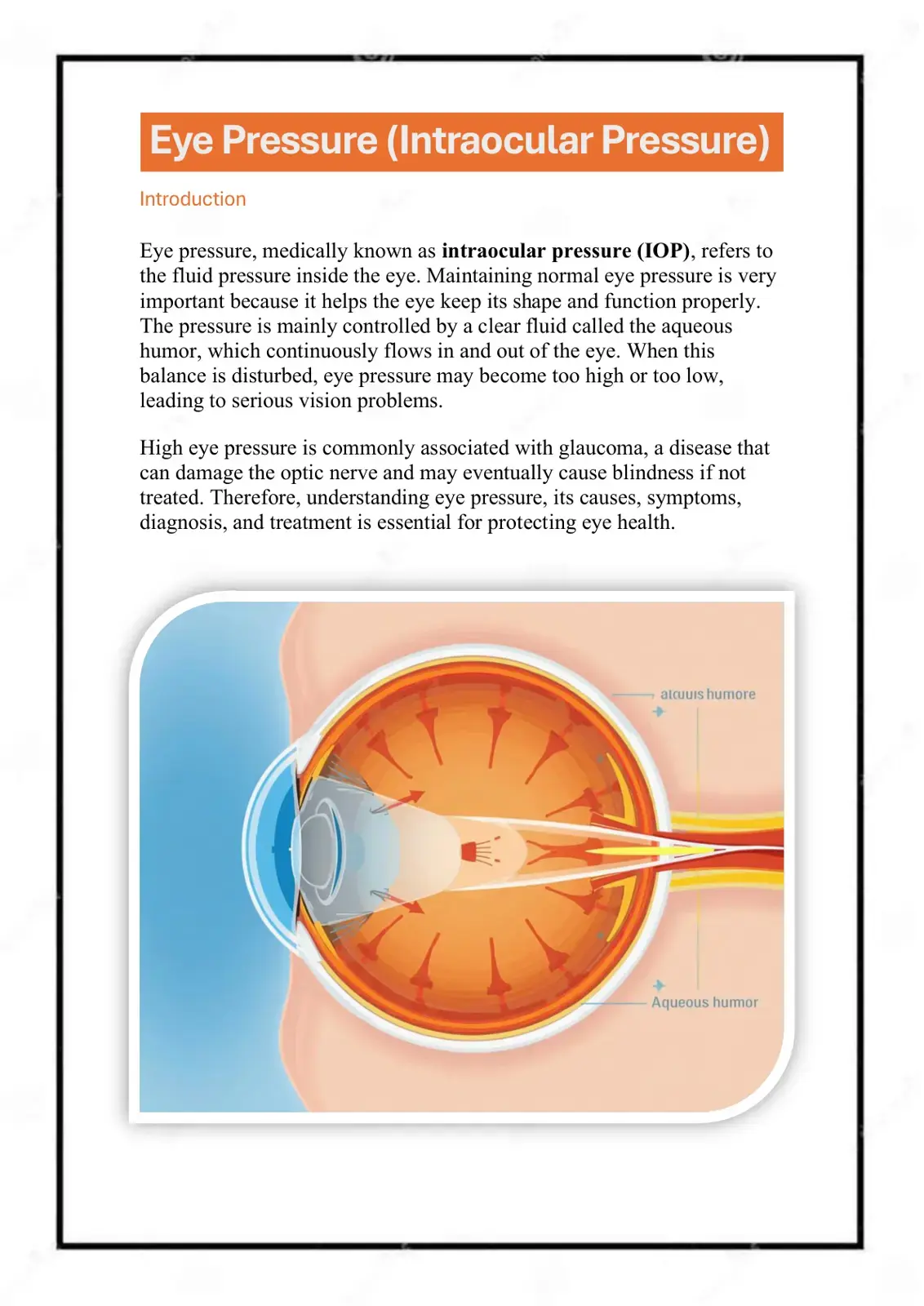 غلاف كتاب Eye Pressure (Intraocular Pressure)