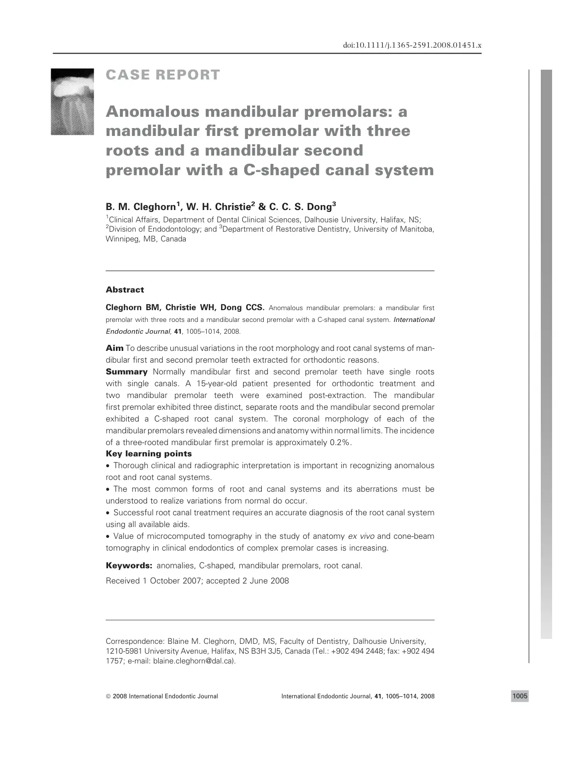 غلاف تقرير Anomalous Mandibular Premolars: A Mandibular First Premolar with Three Roots and a Mandibular Second Premolar with a C-shaped Canal System