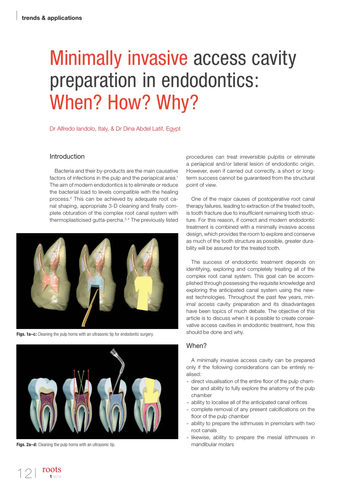 غلاف تقرير Minimally invasive access cavity preparation in endodontics: When? How? Why?