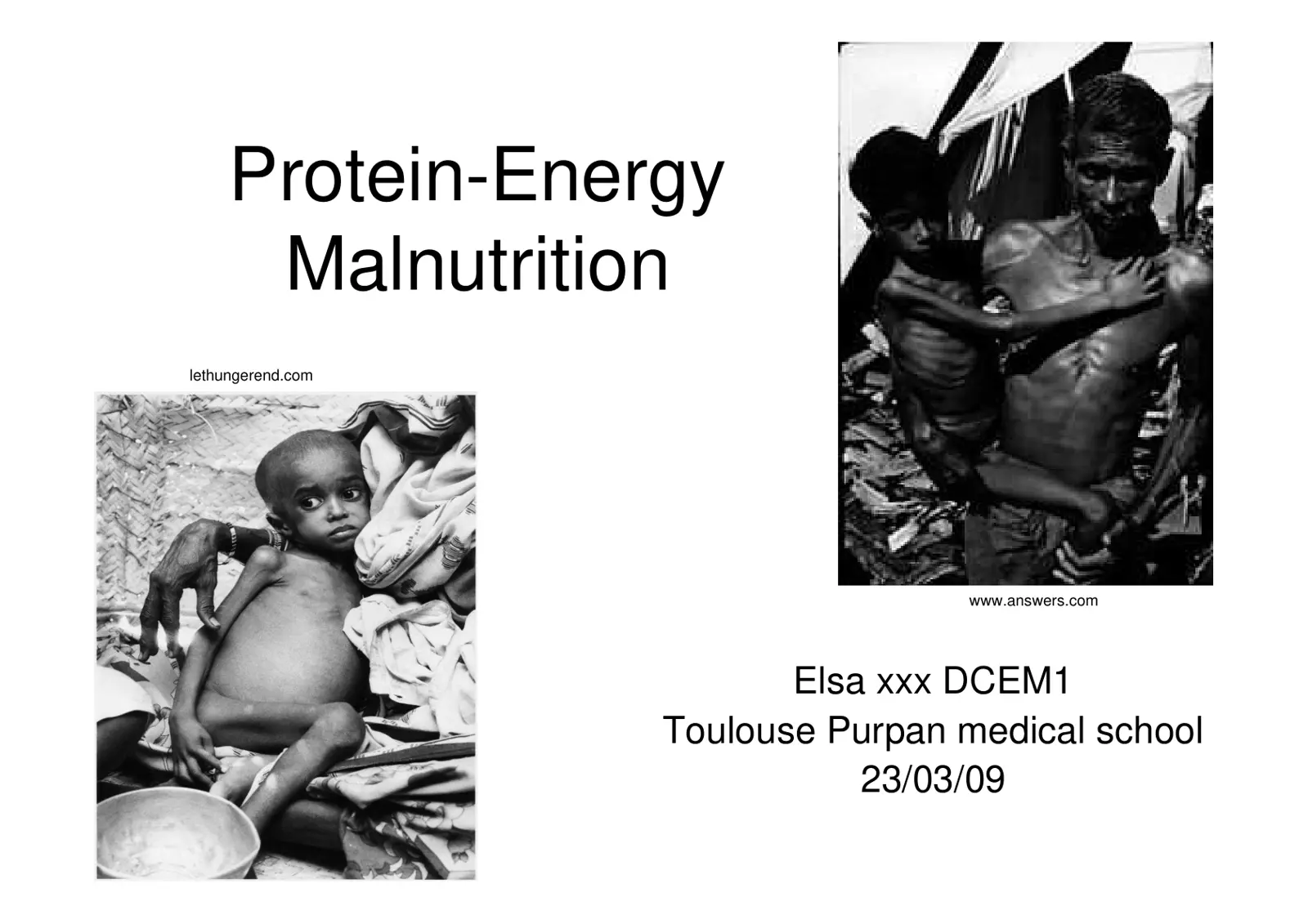 غلاف تقرير Protein-Energy Malnutrition