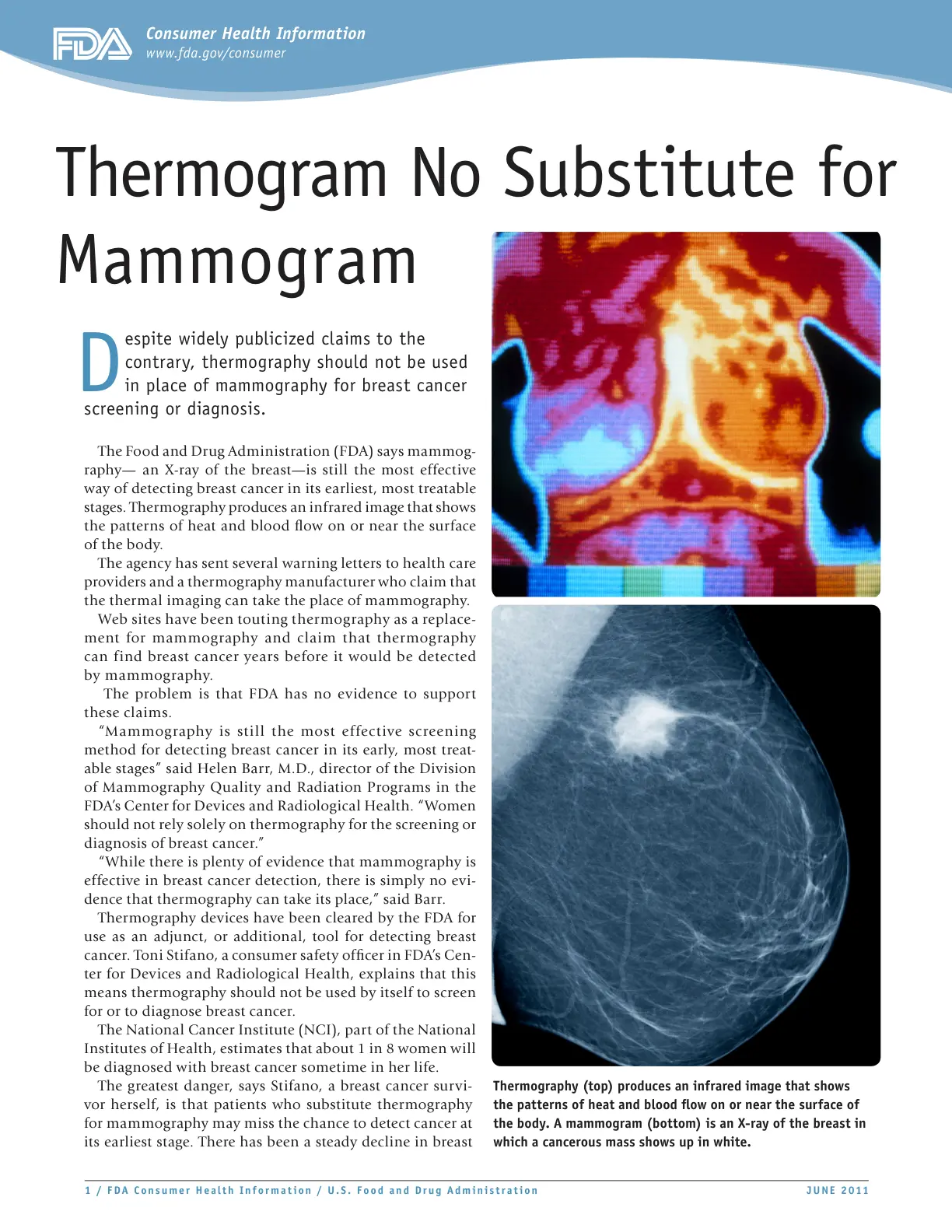 غلاف تقرير Thermogram No Substitute for Mammogram
