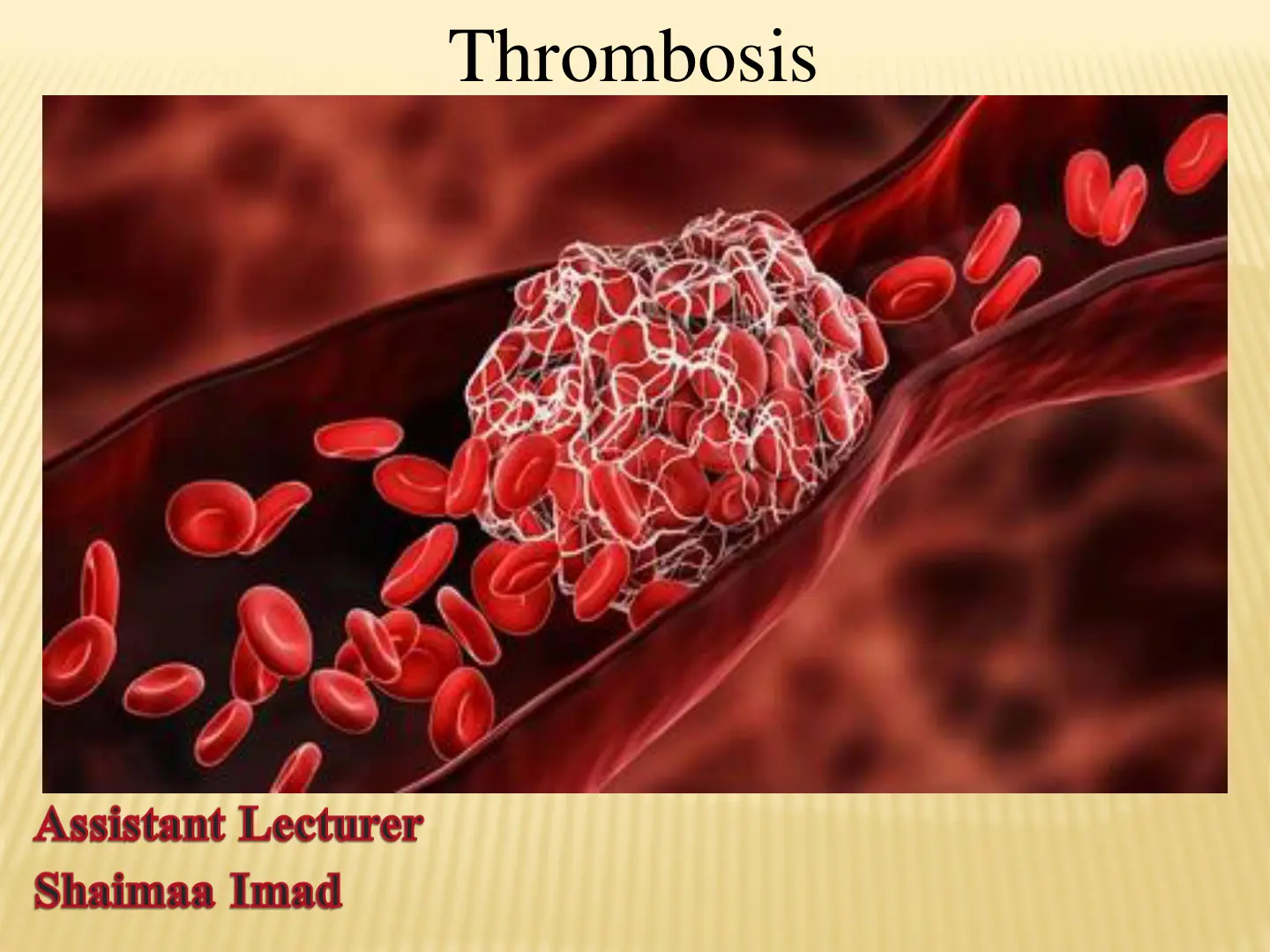 غلاف تقرير Thrombosis