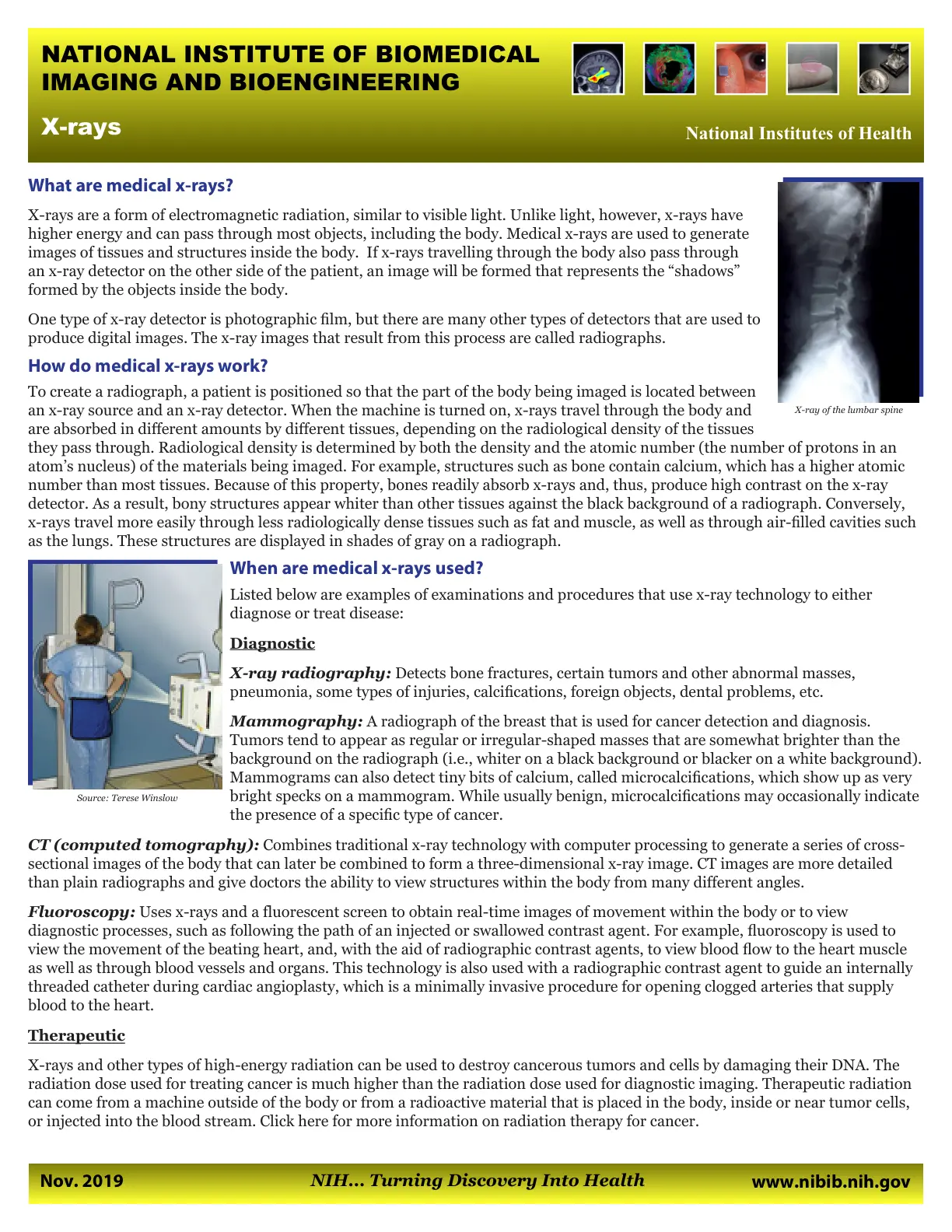 غلاف تقرير X-rays