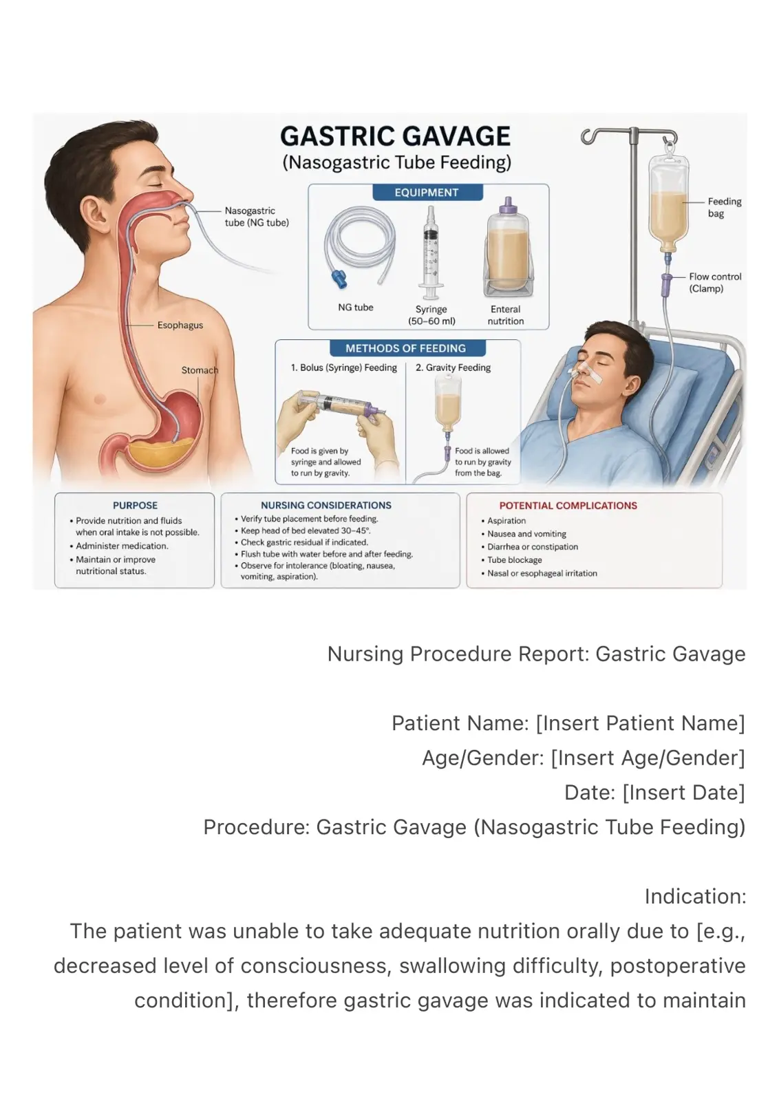 غلاف تقرير Gastric Gavage (Nasogastric Tube Feeding)
