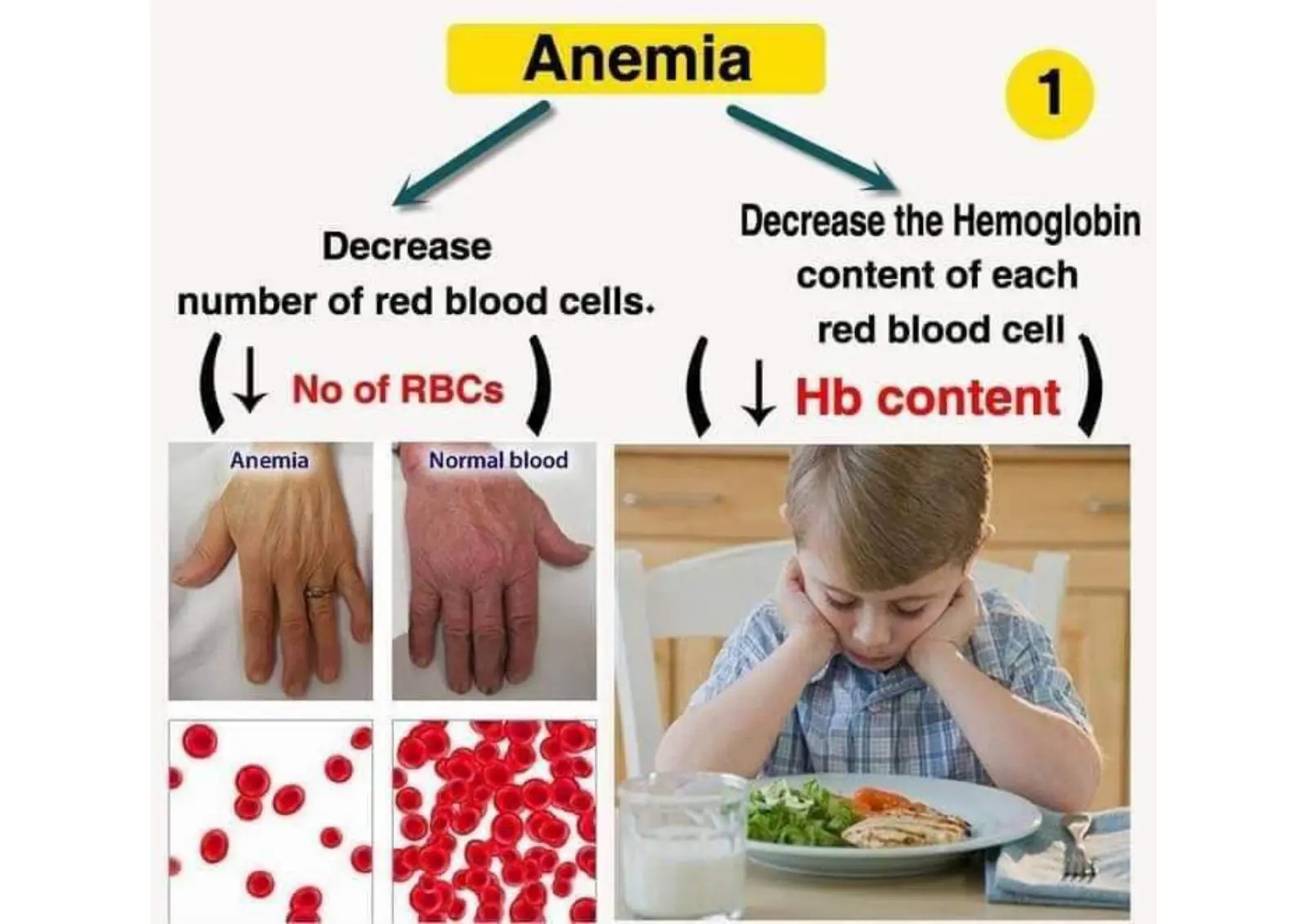 غلاف تقرير Anemia - Decrease in Red Blood Cells