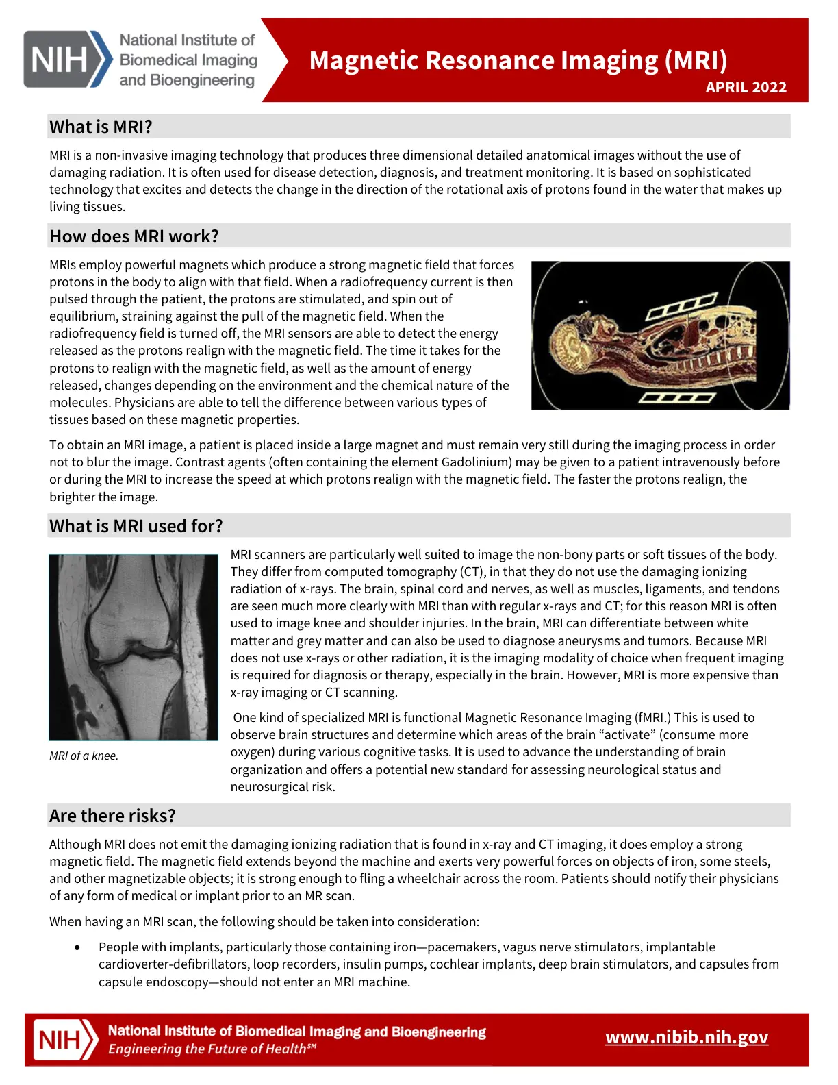 غلاف تقرير What is MRI? Magnetic Resonance Imaging (MRI)