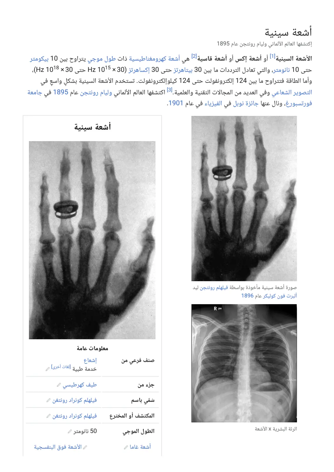 غلاف تقرير أشعة سينية